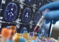 United Kingdom, High Wycombe, Alzheimer's and Dementia Research, Scientist holding a blood sample during a clinical trial with a MRI on screen